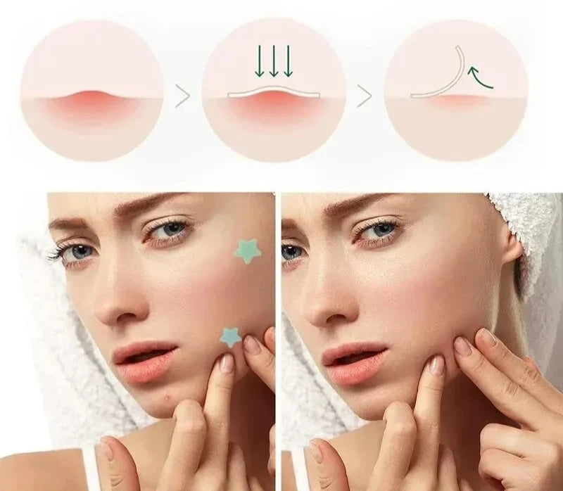 Acne Repair Patch
